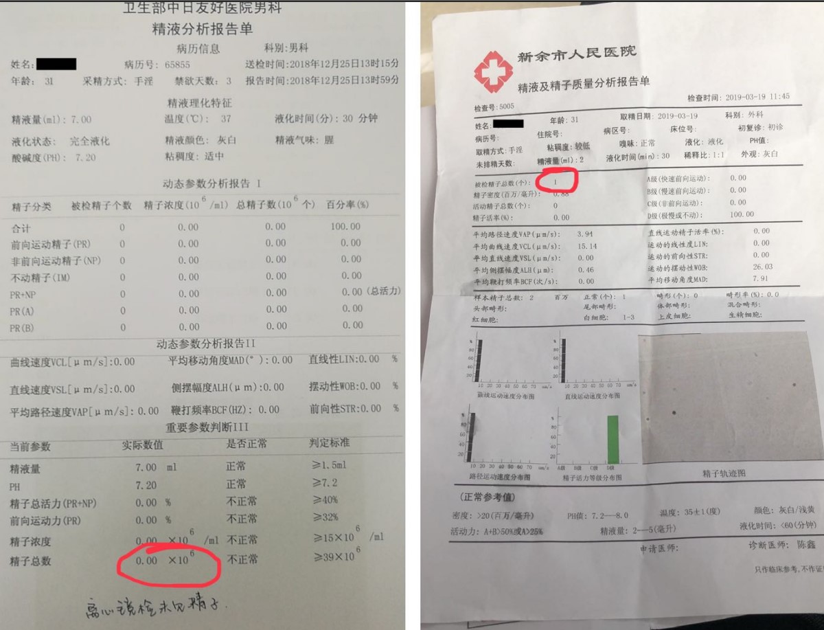 干细胞睾丸再生技术