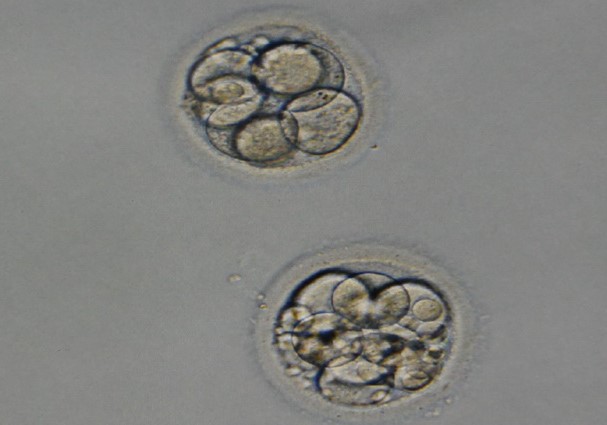 个体化iPS制备和分化成精原细胞/卵原细胞让无精子、无卵子患者也能拥有自己的健康宝宝