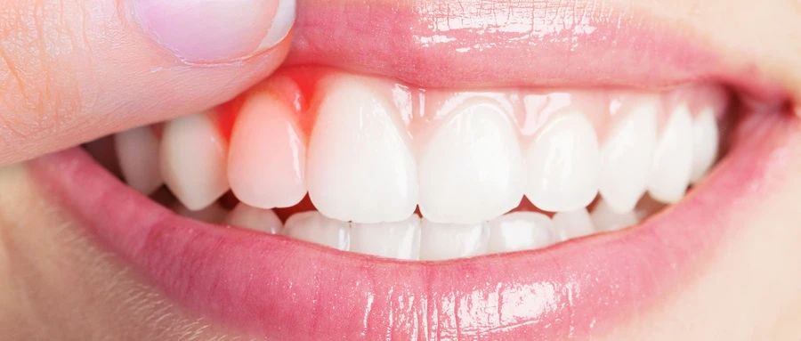 牙齿再生不是梦，世界首款牙齿再生药物临床试验，可促进牙齿第三次发育