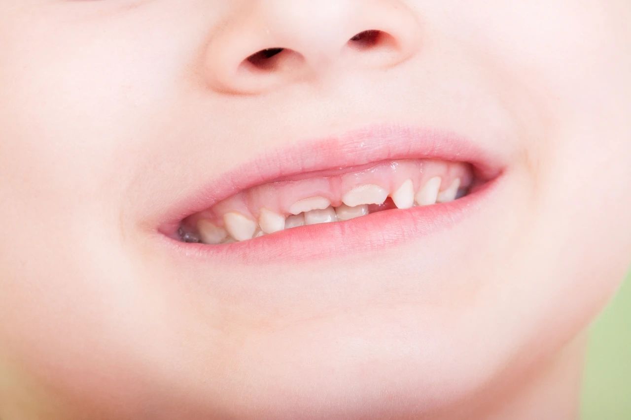 乳牙牙髓干细胞在口腔颌面疾病治疗中的应用