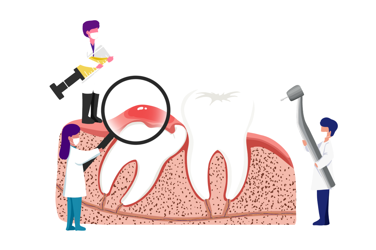 乳牙牙髓干细胞在口腔颌面疾病治疗中的应用