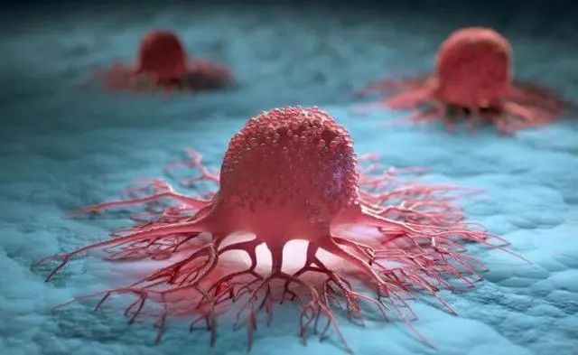 这4类癌症复发率超80%，术后提高体内免疫细胞数量成为关键！
