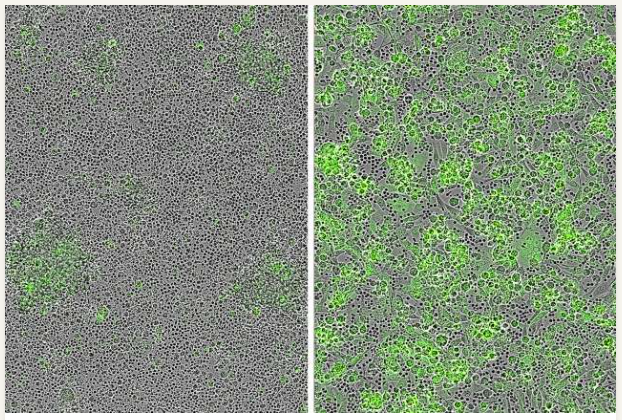 研究人员发现CAR-T细胞疗法的新靶点，可对皮肤和罕见黑色素瘤产生有效的抗肿瘤反应